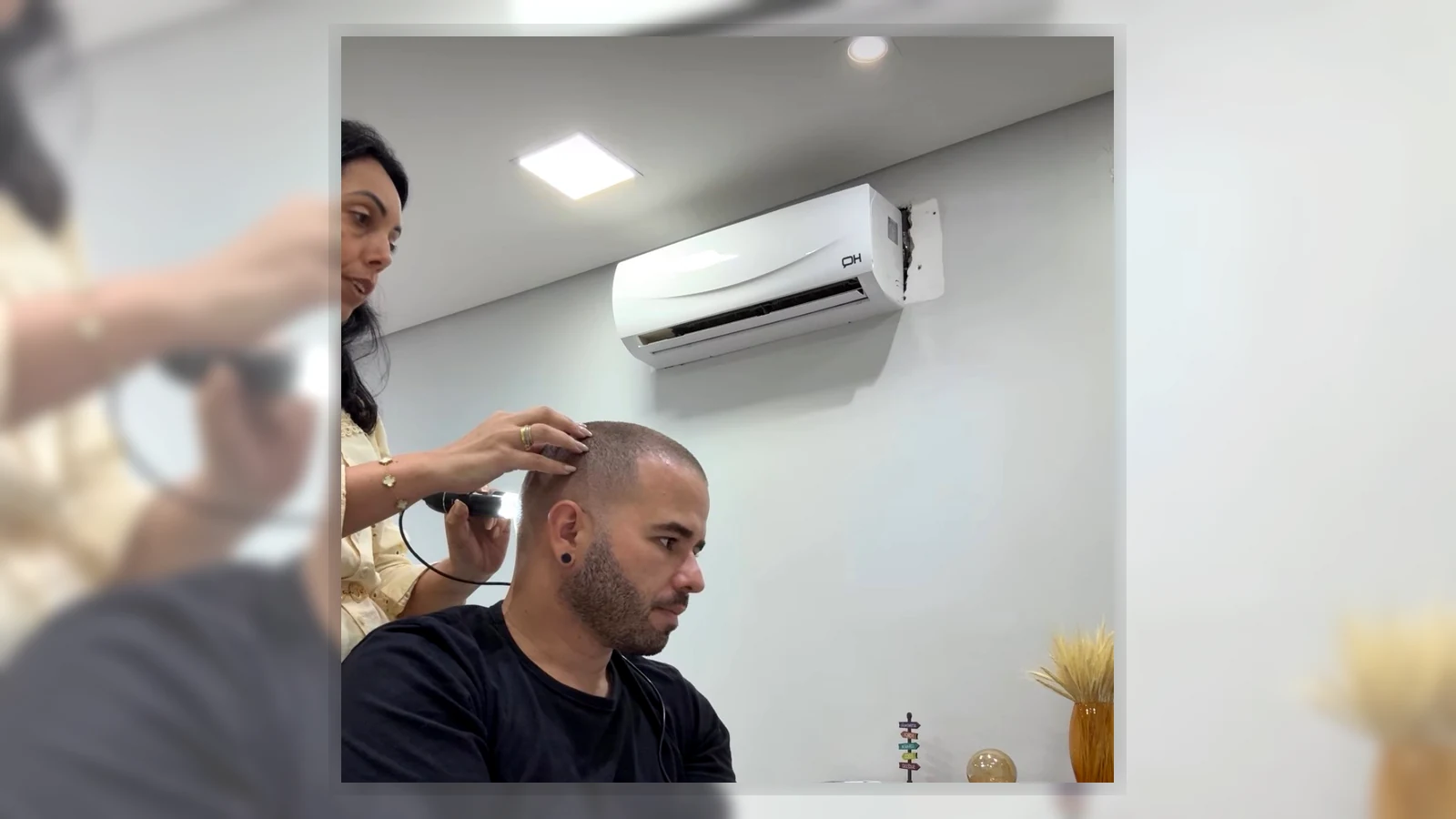 Avaliação capilar especializada na Vital Fios em Botucatu com análise do couro cabeludo